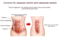 COBCO 2 In 1 Postpartum Belly Belt -Baby Products Store 2 in 1 postpartum belly band waist pelvis belt proactive baby 37501432266994